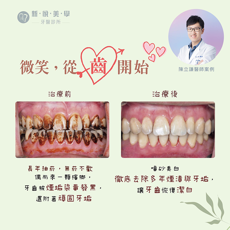 新悅美學牙醫診所的案例分享圖片